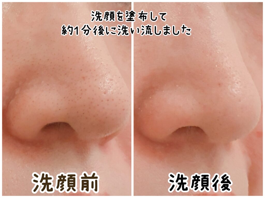 「ビオレ おうちdeエステ ディープクレイ洗顔」(角栓崩壊洗顔)を実際に鼻へ使い、洗顔前と洗顔後を撮影した画像